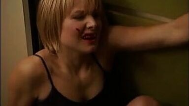 Kristen Bell with a bleeding lip and in pajamas