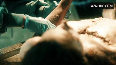 It's time for an autopsy